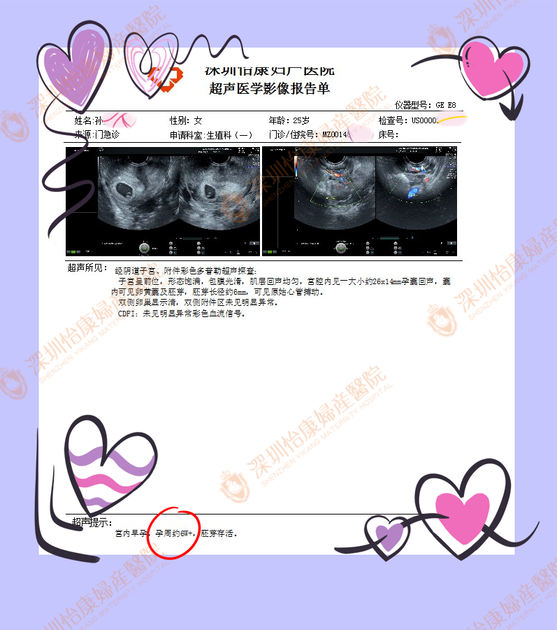 9db5894181e1449cdb407c7ed0b1b61(1).png