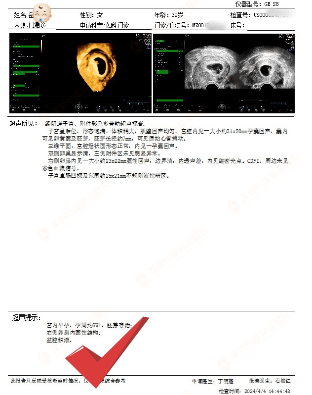 e427ef49ae663a0e1c6a6cca19ce78a.png